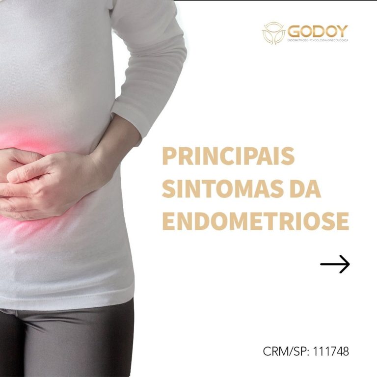 Principais Sintomas Da Endometriose Dr Godoy